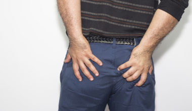 Hemoroid tedavisi
