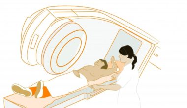 Işın Tedavisi (Radyoterapi) Nedir?