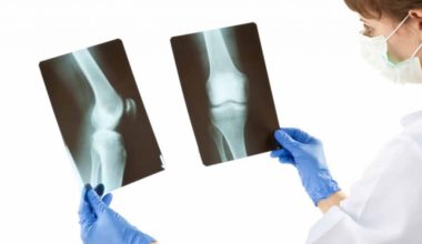 Ortopedi ve Travmatoloji