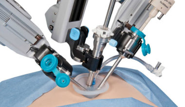 Robotik Cerrahi Nedir?