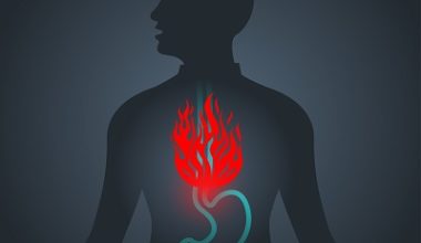 Mide Yanması Nedir? Mide Yanmasına Ne İyi Gelir?