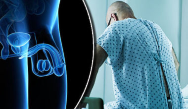 Penis Kanseri Nedir? Belirtileri Nelerdir?