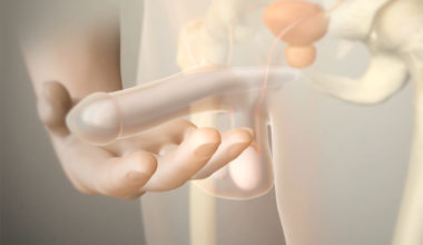 Mutluluk Çubuğu Nedir?