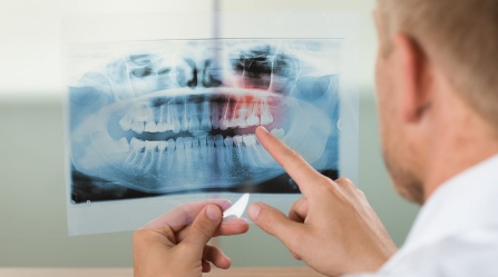 ağız diş çene radyolojisi