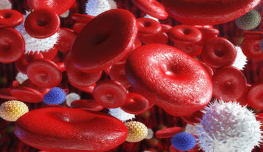 Hematoloji
