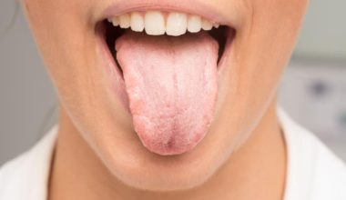 Ağız Kuruluğuna Hangi Bölüm Bakar?