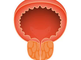 Kronik Prostatit