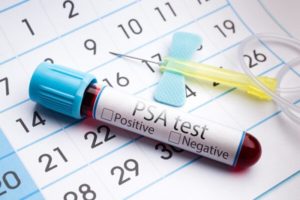 Kan PSA Testi